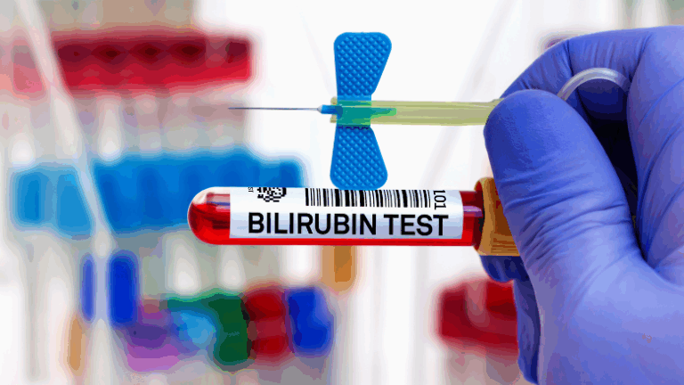 Bilirubin4
