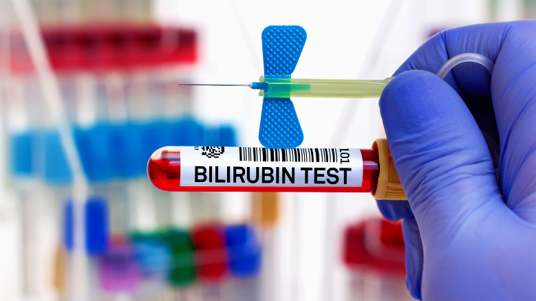 Bilirubin4
